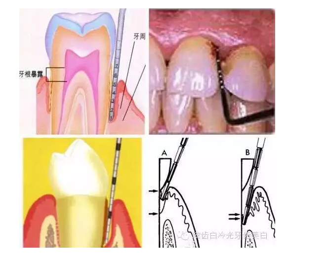 口腔檢查都有哪些流程？