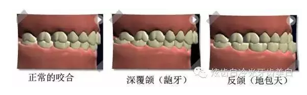 口腔檢查都有哪些流程？