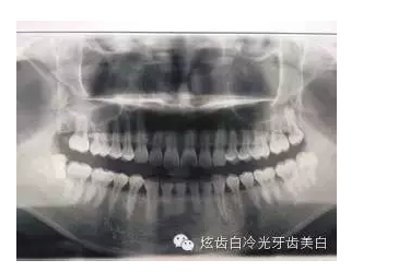 口腔檢查都有哪些流程？