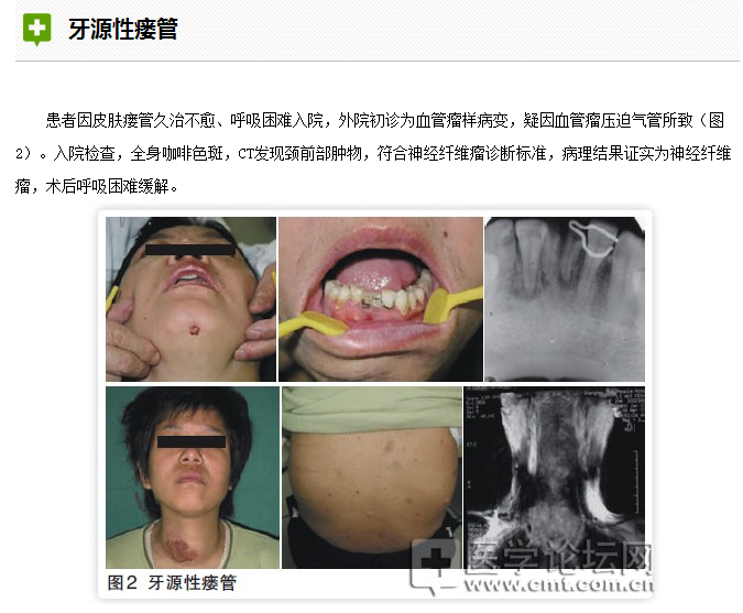 口腔疾病與全身系統(tǒng)性疾病的關系 口腔疾病與全身系統(tǒng)性疾病的關系