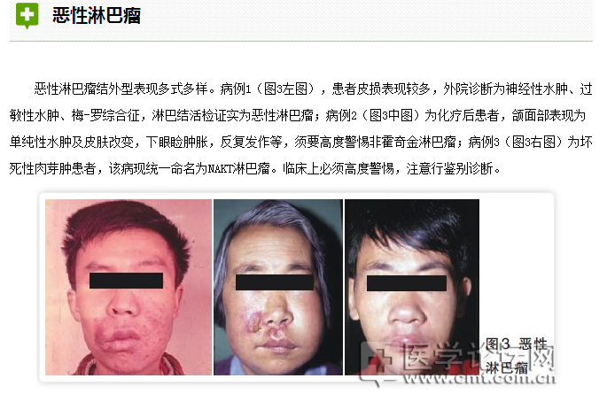 口腔疾病與全身系統(tǒng)性疾病的關系 口腔疾病與全身系統(tǒng)性疾病的關系