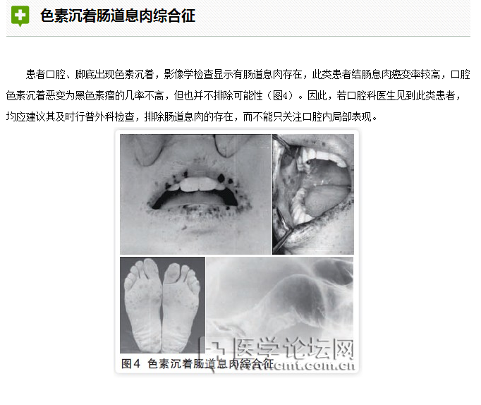 口腔疾病與全身系統(tǒng)性疾病的關系 口腔疾病與全身系統(tǒng)性疾病的關系