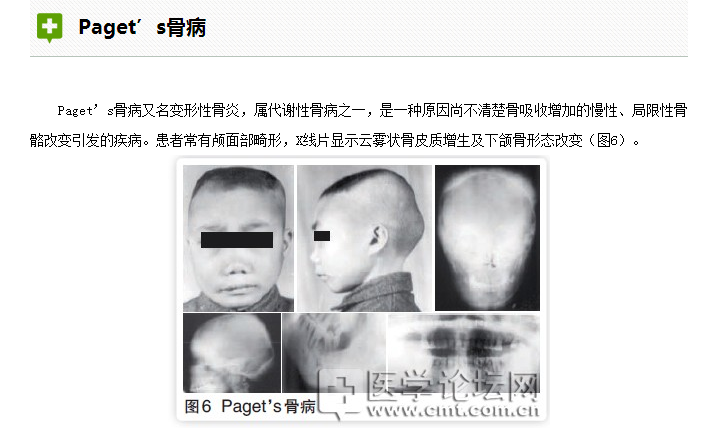 口腔疾病與全身系統(tǒng)性疾病的關系 口腔疾病與全身系統(tǒng)性疾病的關系