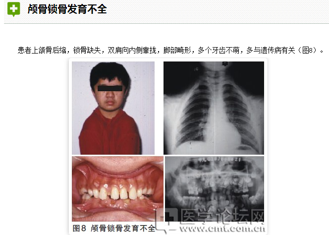 口腔疾病與全身系統(tǒng)性疾病的關系 口腔疾病與全身系統(tǒng)性疾病的關系