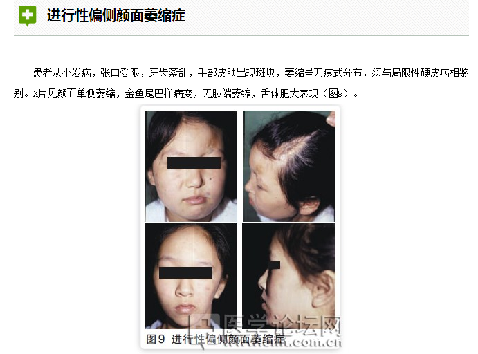 口腔疾病與全身系統(tǒng)性疾病的關系 口腔疾病與全身系統(tǒng)性疾病的關系