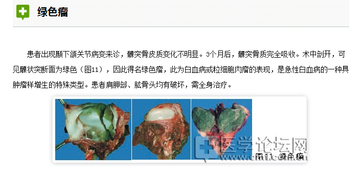 口腔疾病與全身系統(tǒng)性疾病的關系 口腔疾病與全身系統(tǒng)性疾病的關系