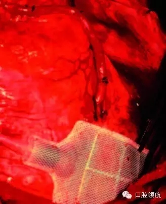 640.webp (4).jpg 640.webp (4).jpg