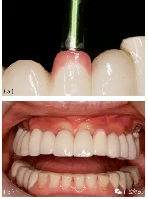 2.webp.jpg 2.webp.jpg