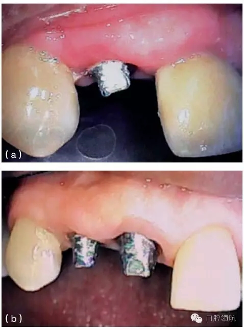 3.webp.jpg 3.webp.jpg