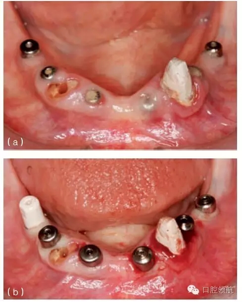 5.webp.jpg 5.webp.jpg