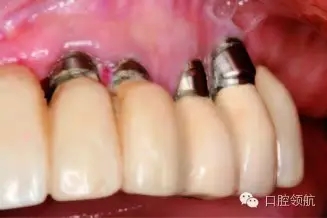 12.webp.jpg 12.webp.jpg