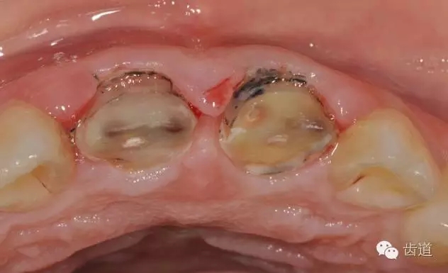 6.webp.jpg 6.webp.jpg