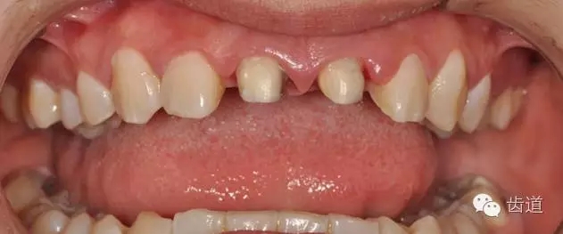 9.webp.jpg 9.webp.jpg