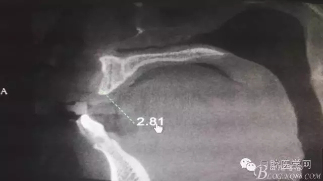 640.webp (1).jpg 640.webp (1).jpg