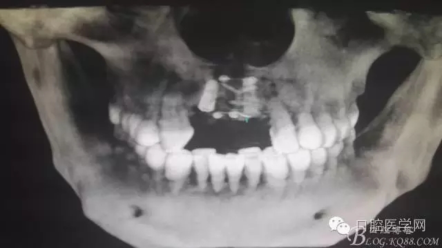 640.webp (6).jpg 640.webp (6).jpg