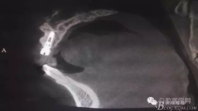 640.webp (10).jpg 640.webp (10).jpg