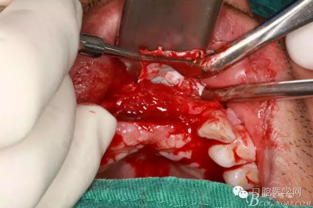 640.webp (12).jpg 640.webp (12).jpg