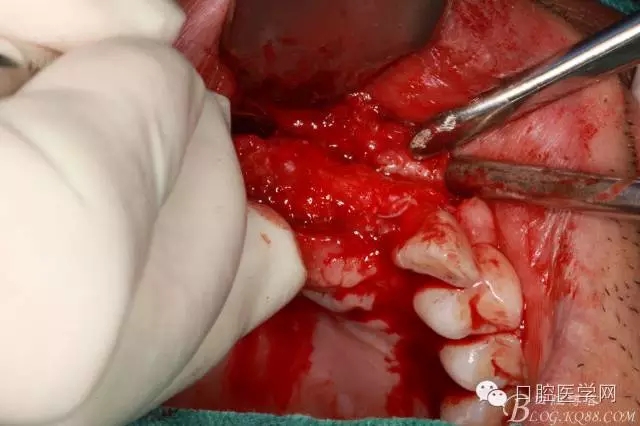 640.webp (14).jpg 640.webp (14).jpg