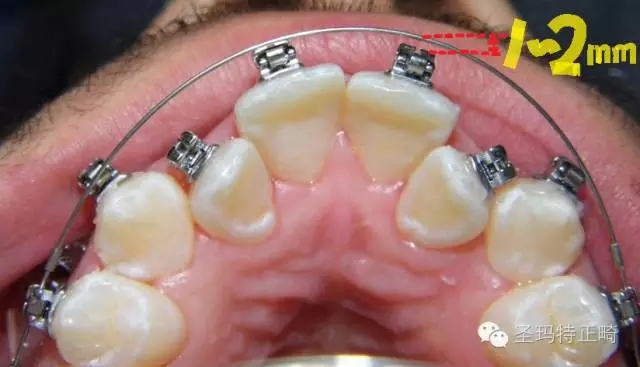 640.webp (2).jpg 640.webp (2).jpg