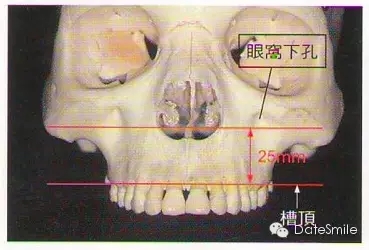 0.webp.jpg 0.webp.jpg