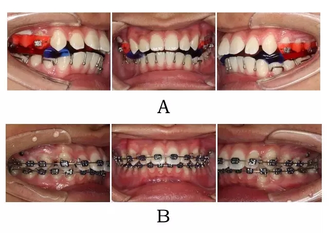 640.webp (2).jpg 640.webp (2).jpg