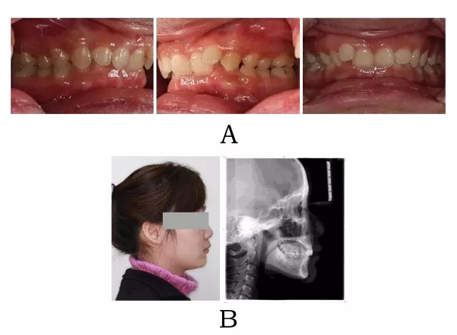 640.webp (4).jpg 640.webp (4).jpg