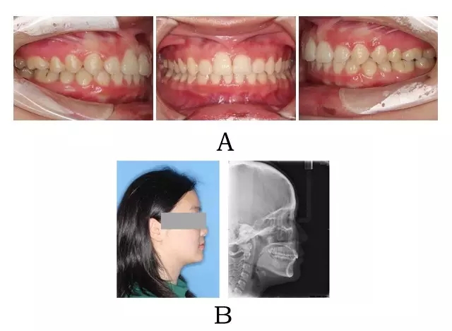 640.webp (6).jpg 640.webp (6).jpg