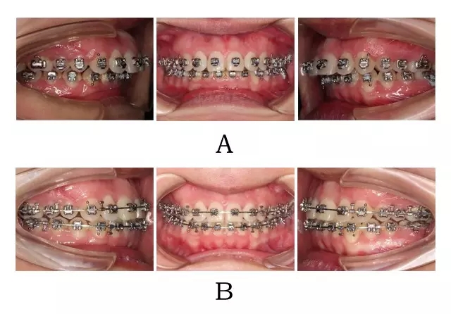 640.webp (7).jpg 640.webp (7).jpg