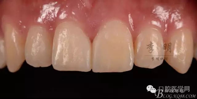 640.webp (4).jpg 640.webp (4).jpg