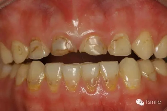 640.webp.jpg 640.webp.jpg