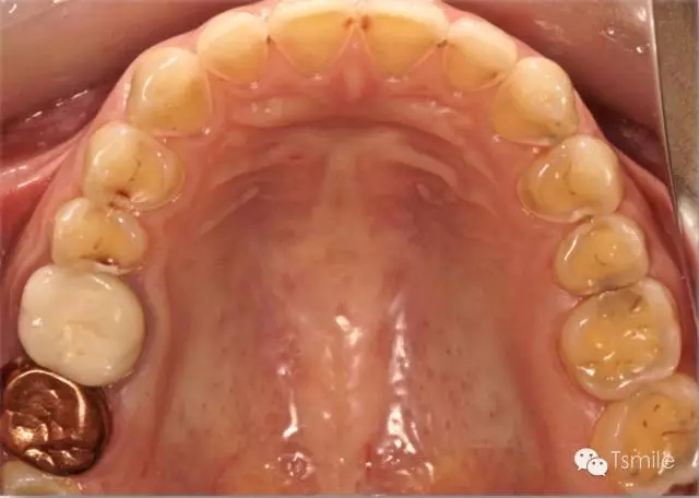 640.webp (1).jpg 640.webp (1).jpg