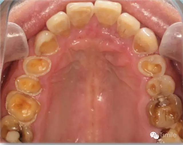 640.webp (2).jpg 640.webp (2).jpg