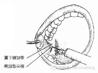 0.webp (4).jpg 0.webp (4).jpg