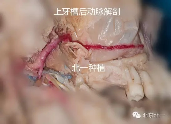 640.webp.jpg 640.webp.jpg