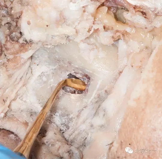 640.webp (5).jpg 640.webp (5).jpg