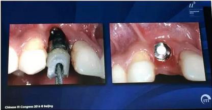 360截圖20170119173521778.jpg 360截圖20170119173521778.jpg