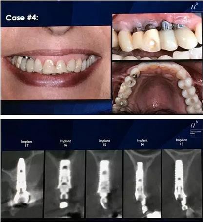 360截圖20170119173713377.jpg 360截圖20170119173713377.jpg