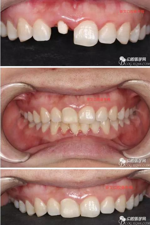 360截圖20170120163759213.jpg 360截圖20170120163759213.jpg