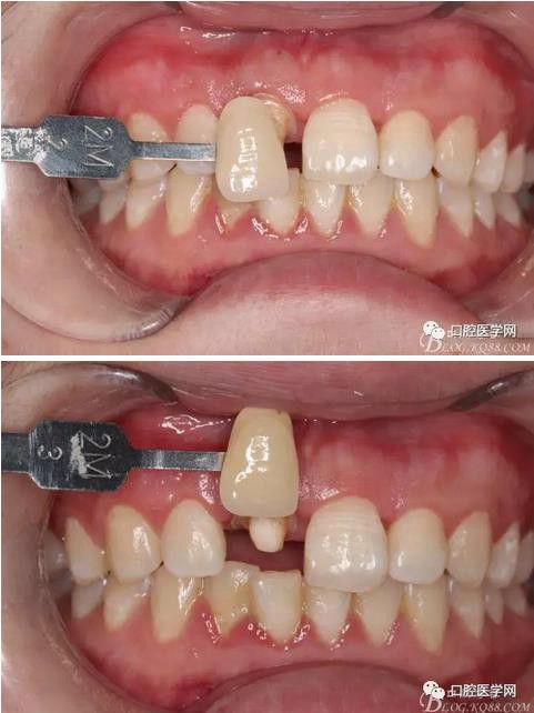 360截圖20170120163945330.jpg 360截圖20170120163945330.jpg