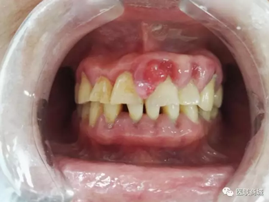 4(IGTP`67Z81A_CNO)Y@SEE.png 4(IGTP`67Z81A_CNO)Y@SEE.png