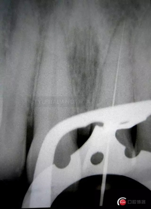 5.webp.jpg 5.webp.jpg