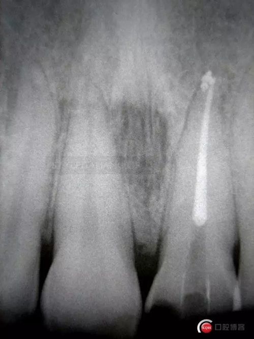 6.webp.jpg 6.webp.jpg