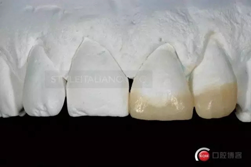 11.webp.jpg 11.webp.jpg