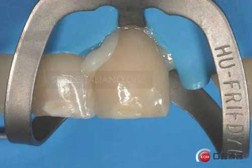 25.webp.jpg 25.webp.jpg