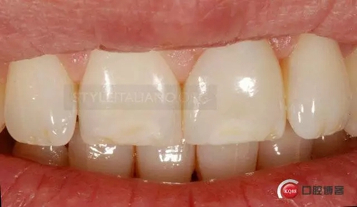 29.webp.jpg 29.webp.jpg