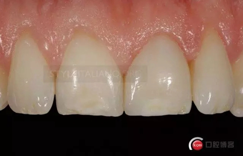 30.webp.jpg 30.webp.jpg