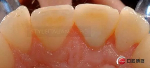 31.webp.jpg 31.webp.jpg