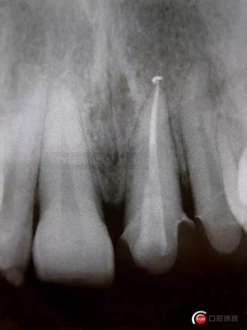 32.webp.jpg 32.webp.jpg