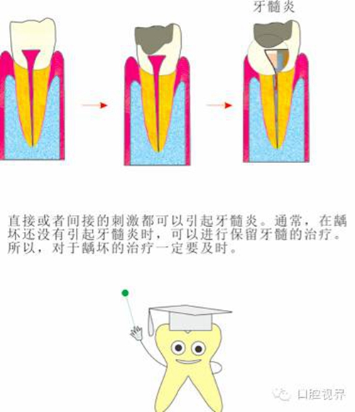 【愛牙科普知識300問】 “什么是融合牙、愈合牙和雙生牙？”