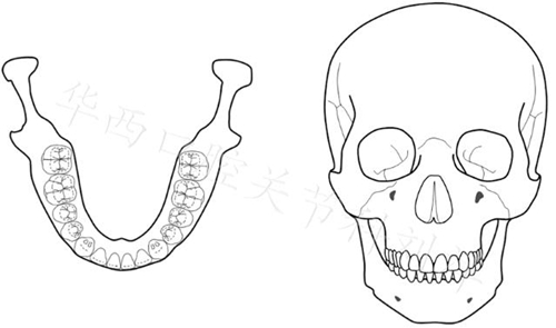 口腔材料對MRI檢查的影像到底有多大？  